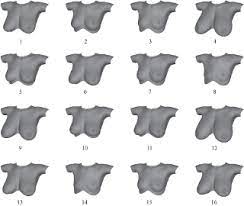 Maybe you would like to learn more about one of these? Development And Psychometric Evaluation Of The Breast Size Satisfaction Scale Emerald Insight