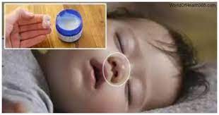 vicks bebeklerde kullanilir mi yanlis kullanim olumle sonuclanmis buna dikkat edin