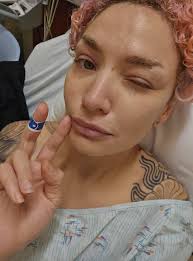 Hi Guys. After some advice. Today I've been diagnosed with an ACL tear  (amongst other things 🙄) that I did a month ago at a local comp. Any one  in here been