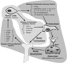 One of the functions of the thyroid gland is to make thyroid hormone, which requires iodine. Bone Metastases In Thyroid Cancer Sciencedirect