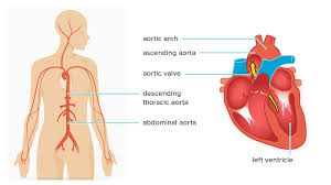 ascending aortic aneurysm repair surgery and size criteria