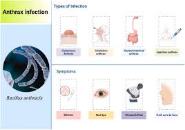 Image result for Anthrax