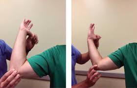 Image result for Elbow Extension Test
