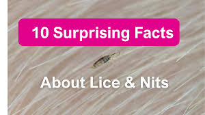 Image result for lice vs nits