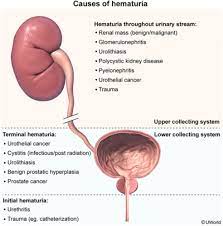 Peyronie disease is the only term used to identify the pathophysiologic condition described. Surgery Shelf Review Flashcards Quizlet