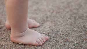 Salah satu penyebab terjadinya kondisi kaki o yang berkepanjangan pada balita adalah penyakit blount, yaitu kelainan pertumbuhan pada tulang tungkai anak. Cegah Kelainan Tulang Kaki Pada Anak Dengan Tidak Melakukan 5 Hal Ini Kumparan Com