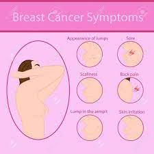 Those in whose ancestry there is a history of breast cancer related to brca1 or brca2 gene mutations, for example, people with ashkenazi jewish ancestry. Breast Cancer Symptoms Vector Illustration Royalty Free Cliparts Vectors And Stock Illustration Image 85638567