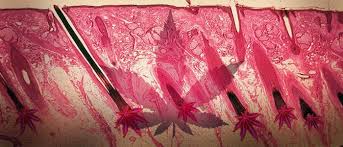 Yes, thc can even show up in your hair follicles! How To Pass A Hair Follicle Drug Test Green Rush Daily