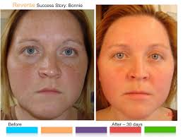 Anti-aging Products Billings MT