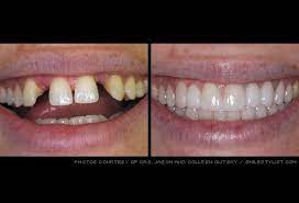Pin On Dental