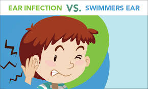 We explain how you can tell the difference between the an ear infection and teething, and how to comfort your little one. Swimmer S Ear Vs Inner Ear Infection Four Ways To Spot The Difference