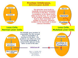 Image result for Hereditary Fructose Intolerance