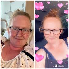 Self-pay bariatric surgery costs without insurance?