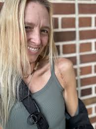 I've got a broken shoulder, explaining all the pain.