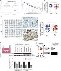 Your husband is fortunate that they caught his lc early. Heterogeneous Nuclear Ribonucleoprotein A2 B1 Is A Negative Regulator Of Human Breast Cancer Metastasis By Maintaining The Balance Of Multiple Genes And Pathways Ebiomedicine