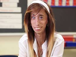 The other person that is considered to be one of the ugliest people is the lady singer that goes by the name lady gaga. Lizzie Velasquez On Her Haters I Would Give Them The Biggest Hug People Com