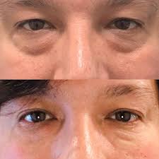 Ray vidal (@thecreativeray) • Instagram photos and videos