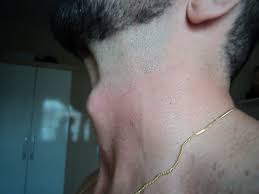 | street quiz | funny videos | funny african videos | african comedy. Huge Adam S Apple 111swe Flickr