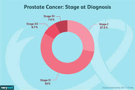 Prostate cancer is one of the most common types of cancer diagnosed in men. How Prostate Cancer Is Diagnosed