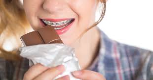 You may want to start with something that is not too crunchy to make sure that this does not cause you any pain. Can I Get A Cavity Filled If I Have Braces Fry Orthodontics