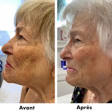 Médico-Esthétique Annie Lapointe