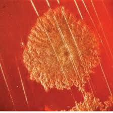 Check spelling or type a new query. Clostridium Botulinum Grows On Blood Agar Causing Hemolysis Of Type Download Scientific Diagram