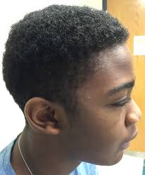 It is named for judith hall and philip pallister. Pallister Hall Syndrome Atlas Of Human Malformation Syndromes In Diverse Populations