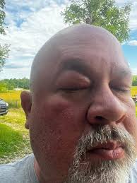 I get my first set of bees today!! Wish me luck. Newbee here