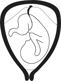 Image result for Compound Presentation