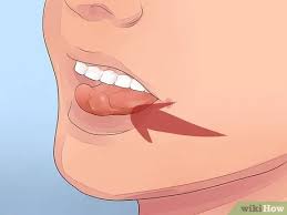 Como Hacer Que Un Diente Flojo Se Caiga Sin Jalarlo