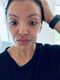 I'm trying the laser loved by Gwyneth Paltrow