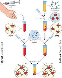 Image result for Direct Coombs