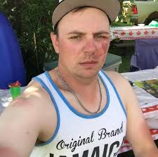 Can I test and delete the P1428 sensor