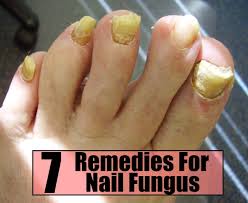 7 Effective Home Remedies For Nail Fungus Nail Fungus Remedy Toenail Fungus Remedies Nail Fungus