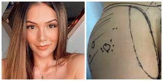 Maybe you would like to learn more about one of these? Asi Quedaron Las Nalgas De Lina Tejeiro Tras Operacion Por Biopolimeros Digame Com Co