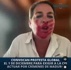 Wilson Sanchez Valentin"