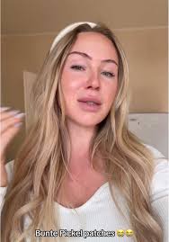 Bunte Pickel Patches und ihre Bedeutung