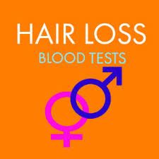 Although abnormalities may be found, many patients have normal blood tests. Heavy Hair Loss Get Prp I Prf Mesotherapy At Nar London Harley St