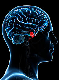 1) quais são as causas da aneurisma cerebral? Aneurisma Causas Y Tratamiento