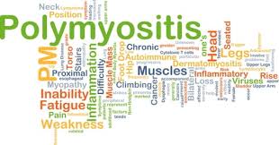 Image result for Polymyositis Management
