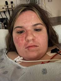 Good evening everyone 😃💕💗. Well guys I got my phone call I have been  waiting for late this afternoon. My results are back from yesterday  morning's bloodwork and the results are amazingly