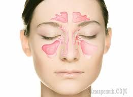болит горло пропал голос как лечить в домашних условиях How To Treat Sinusitis In The Home How To Treat Sinusitis Chest Congestion Congestion Relief