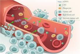 Cancer cells contain a unique set of cell surface receptors that provide. Liquid Biopsy In Hepatocellular Carcinoma Circulating Tumor Cells And Circulating Tumor Dna Molecular Cancer Full Text