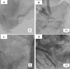 Horoscop 360 de grade, cu alina badic zodia fecioara 25 31 martie 2017. Preparation And Characterization Of Polythiophene Graphene Oxide Epoxy Nanocomposite Coatings With Advanced Properties Springerlink