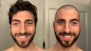 Two cats tested positive for COVID-19 in New York state