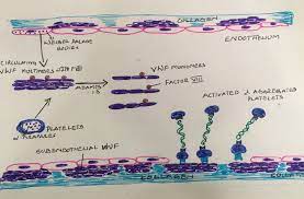 Von Willebrand Disease Histopathology Guru