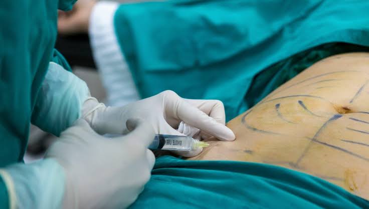 Liposuction in Islamabad | Best Surgeon For Liposuction