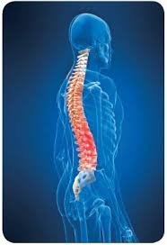 Image result for Vertebral Compression Fracture