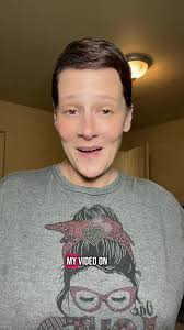 Jenny Eden Scar Salve