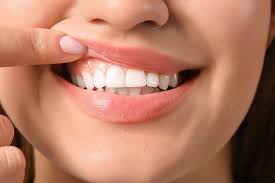 Maintain Dental Health with General and ...